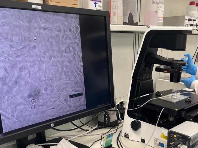 Estudio de investigador Leonés reveló