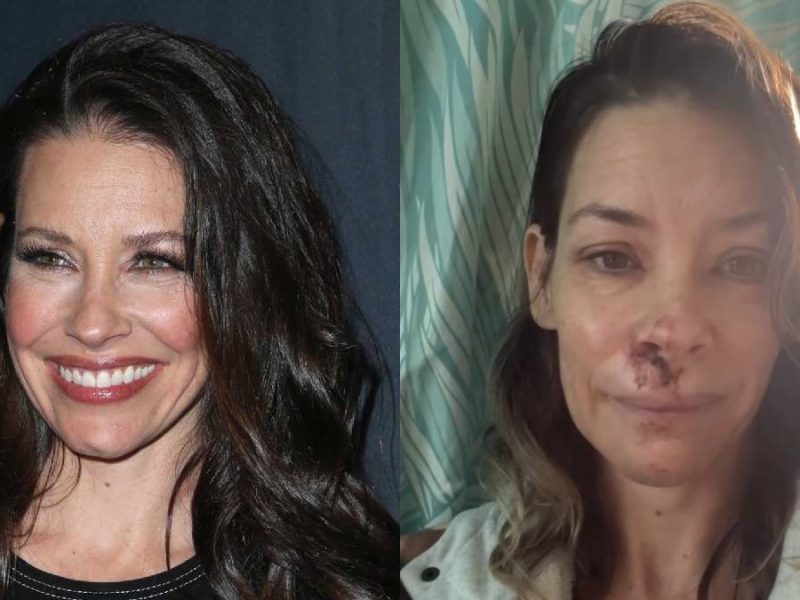 Evangeline Lilly confirma daño cerebral: ¿Qué le pasó a la actriz de Marvel?