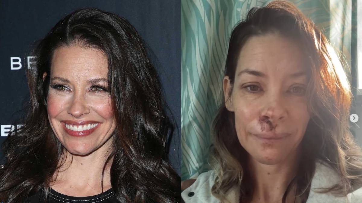 Evangeline Lilly explica en video su diagnóstico de daño cerebral y deterioro cognitivo