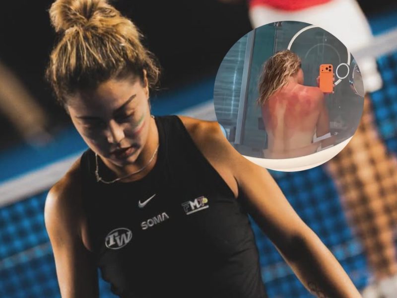 Renata Zarazúa sufre quemaduras en Australia; ‘El sol no es broma’, señala