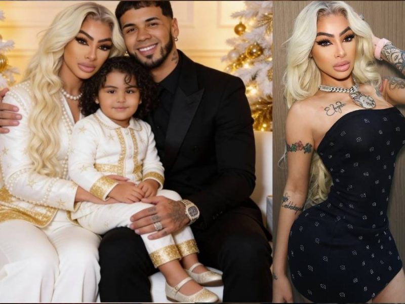 Yailin la Más Viral, ex de Anuel AA, impacta con el resultado de sus cirugías estéticas: ‘Se ve fatal’