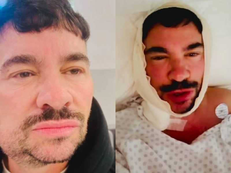 ¿Qué le pasó a Shiky en la cara? Operado de urgencia tras extraña obstrucción