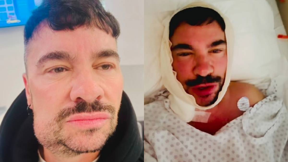 Qué le pasó a Shiky en la cara operado de urgencia