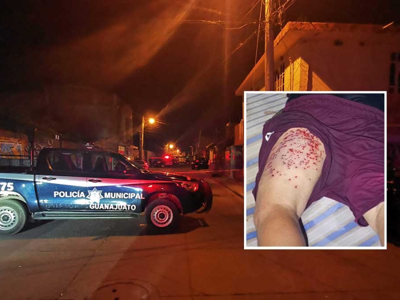 Discusión termina mal: Lo atacan con escopeta “chispera” tras fuerte riña en Acámbaro