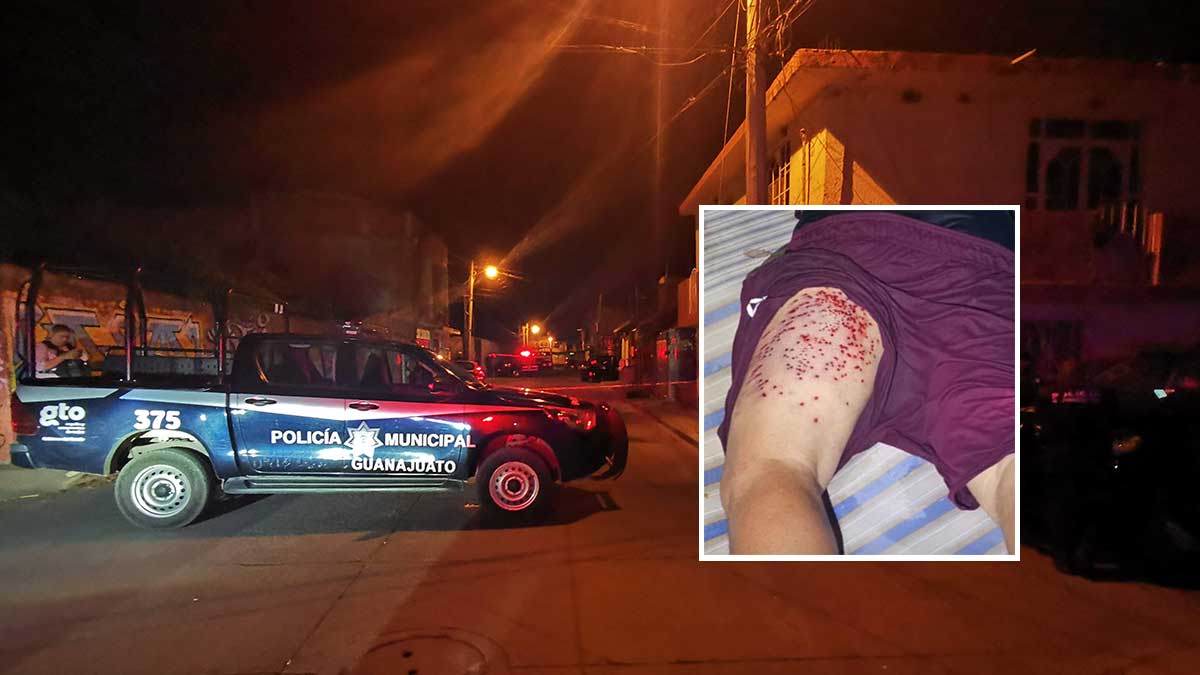 hombre herido en Acámbaro