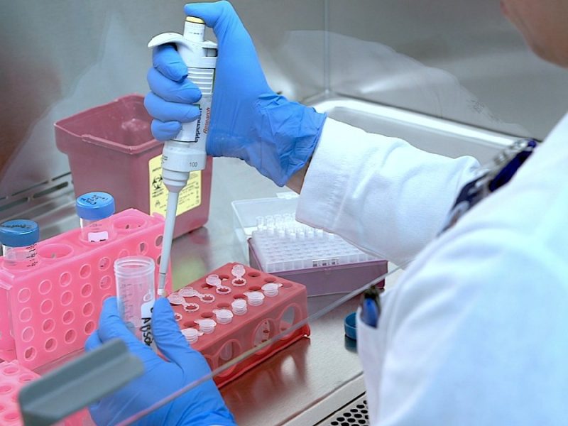 Casos de tuberculosis en Guanajuato suben más del doble en los últimos cinco años