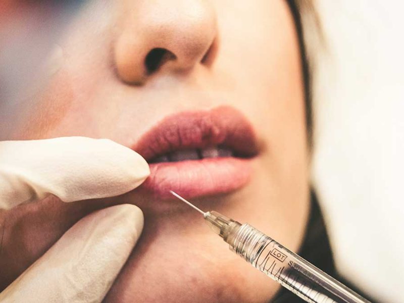 Más allá de la vanidad: Depresión y ansiedad, los rostros ocultos tras cirugías plásticas