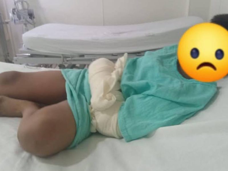 Falta de material en la T-21 del IMSS afecta a niños; uno lleva casi 15 días esperando cirugía