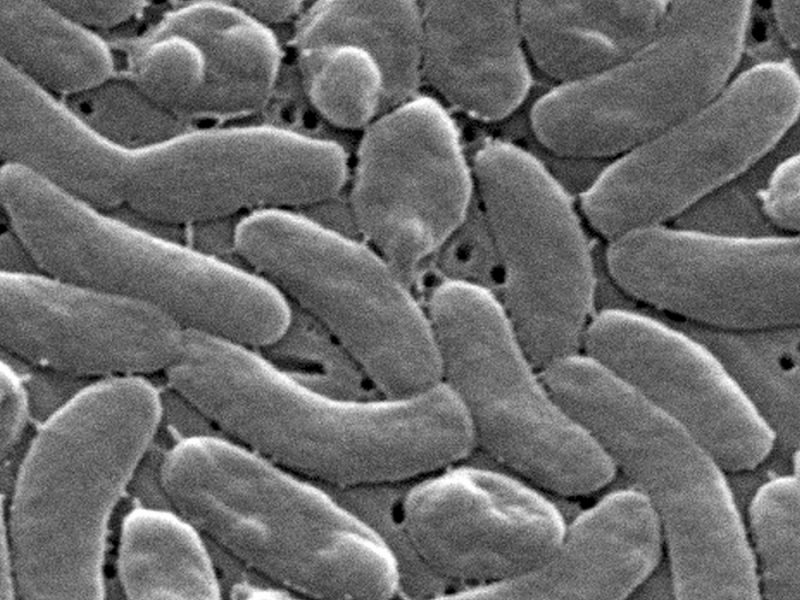 Advierten por bacteria ‘devoradora de carne’, que incluso lleva a la muerte en EU