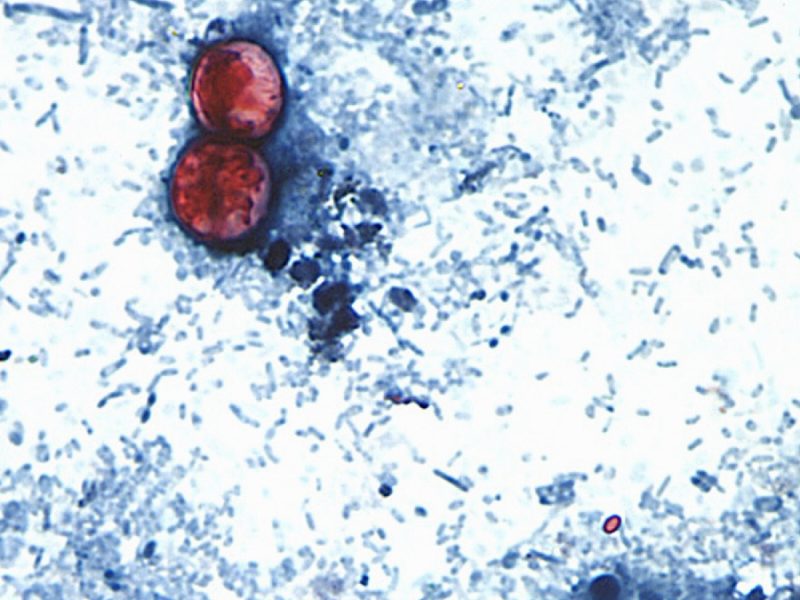 Brote de Cyclospora en EU deja las primeras dos muertes y miles de infectados