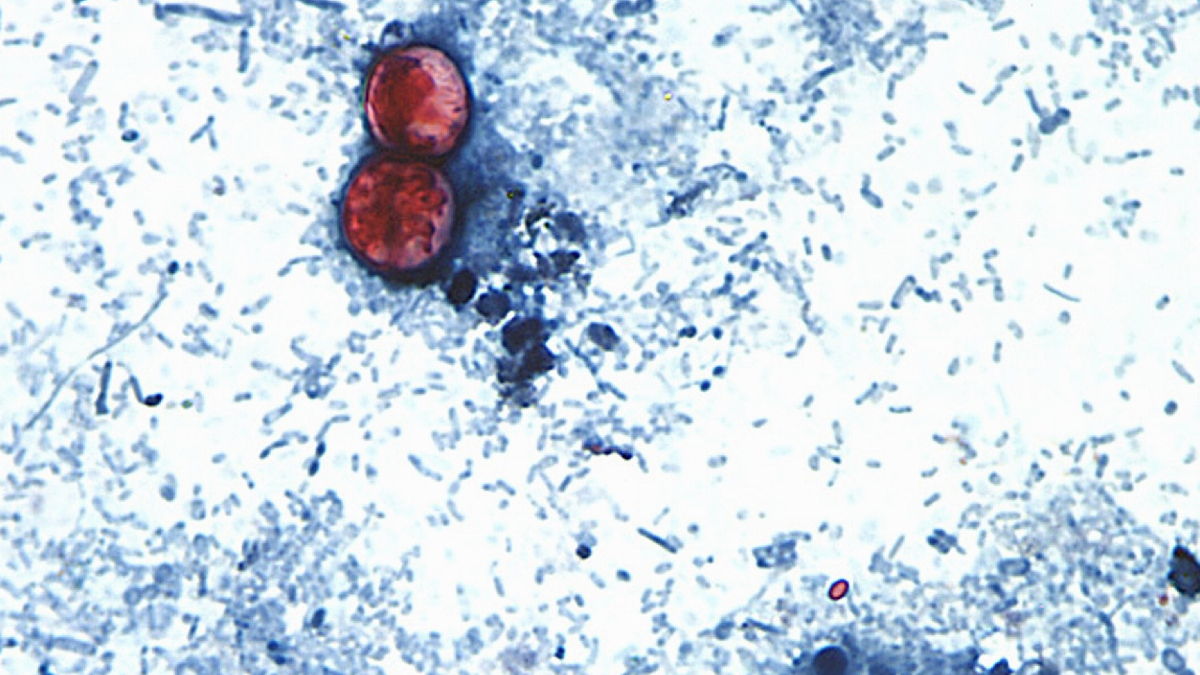 Ciclosporiasis lechuga México