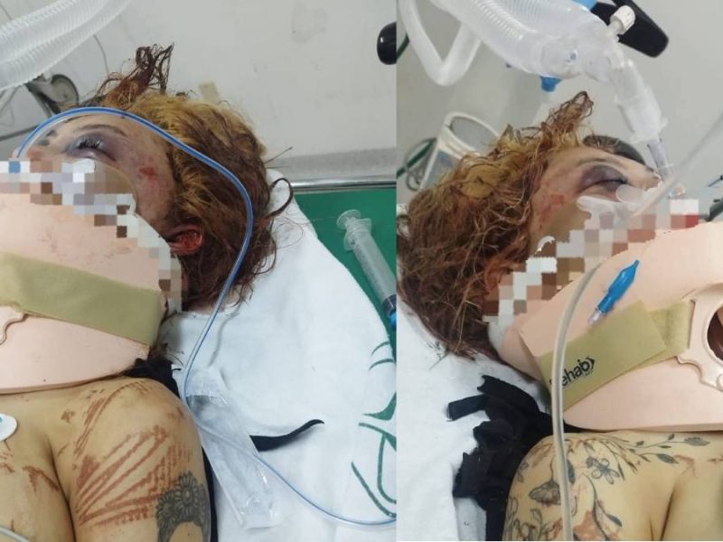 Hallan a mujer brutalmente golpeada en carretera León-Aguascalientes